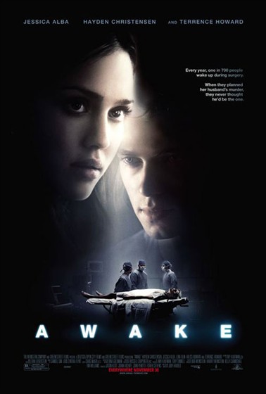 Наркоз (Awake)